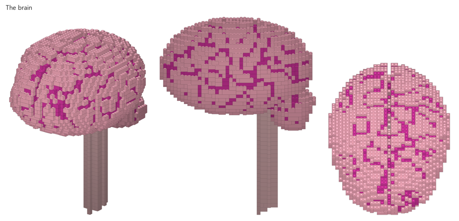 2,287 bricks of brain, with the spinal cord heading off down my neck.